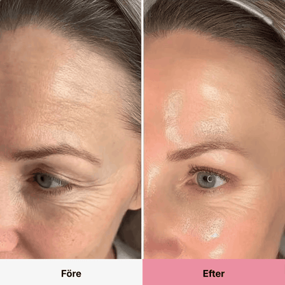 PDRN Collagen Volume Balm RITÚEL